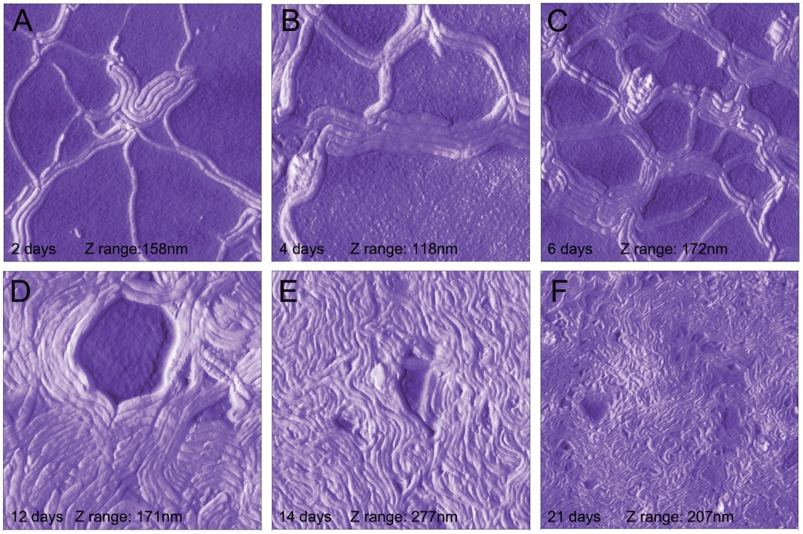 Scanning electron micrograph of Borrelia burgdorferi biofilm — figure from Sapi et al. 2012 PLoS One showing biofilm aggregate structure