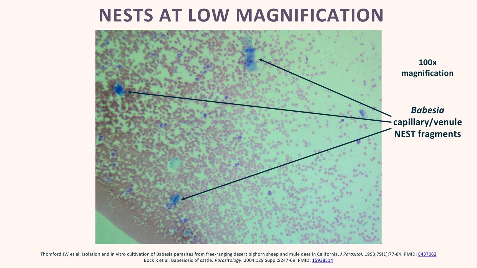 Lindner presentation slide showing low-magnification Babesia capillary and venule nest fragments